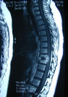 Contrast-enhanced sagittal T1-weighted MRI image i