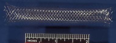 An intravascular stent used in the creation of a p