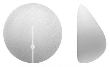 Sientra shaped round implants. 