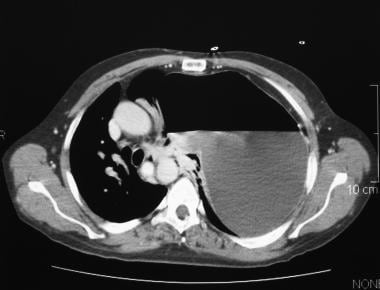 An axial contrast-enhanced CT scan viewed on media