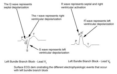 what is a persantine cardiolite stress test