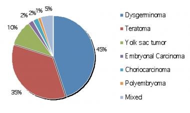 Ovarian dysgerminomas pathology. Percentages of ma