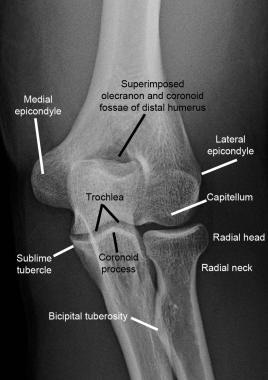 Normal elbow. Normal anteroposterior (AP) radiogra