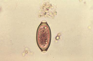 Egg from the "human whipworm". Courtesy of the CDC