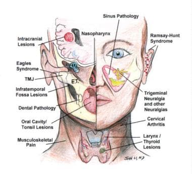 mastoiditis pathophysiology