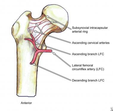 femur fracture anatomy