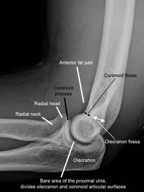 Normal elbow. Normal lateral radiograph of the elb
