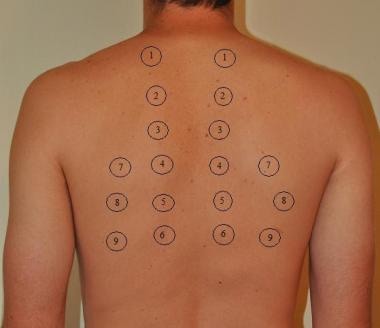 shape of chest, inspection