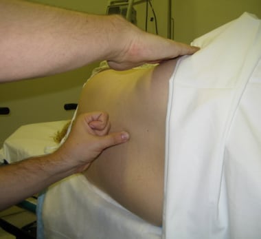Lumbar puncture lateral recumbent position. Image 