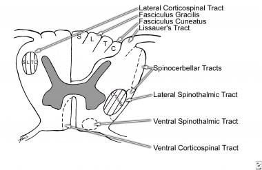 Transverse section of spinal cord showing location