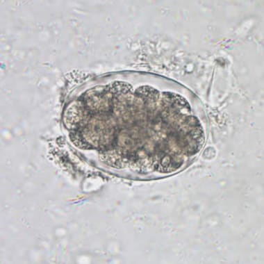 Hookworm egg in an unstained wet mount at 400x mag
