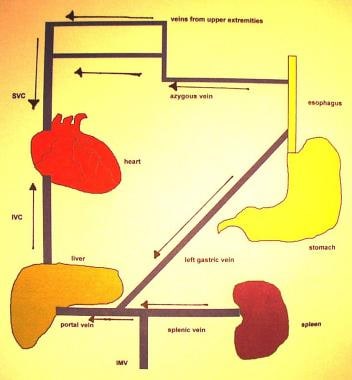 Normal venous flow through the portal and systemic