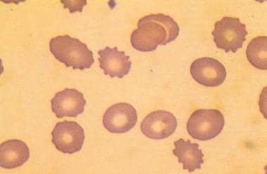 spur cells