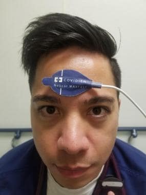 The sensor is placed on the forehead of the patien