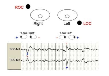 roving eye movements