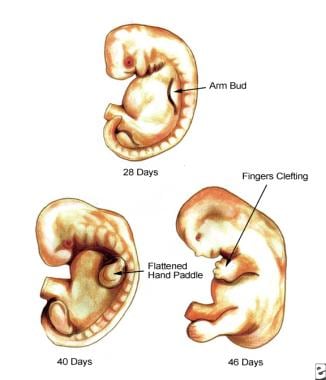 Developing embryo at 28 days, 40 days, and 46 days