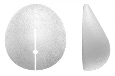 Breast Augmentation (Round Silicone Cohesive Gel Implants)