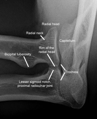 Normal elbow. Normal oblique radiograph of the elb