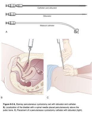 Suprapubic Cystostomy Periprocedural Care: Patient Education and Consent,  Equipment, Patient Preparation