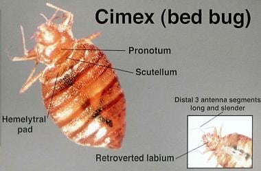 The bedbug is a flat, oval, reddish brown insect t