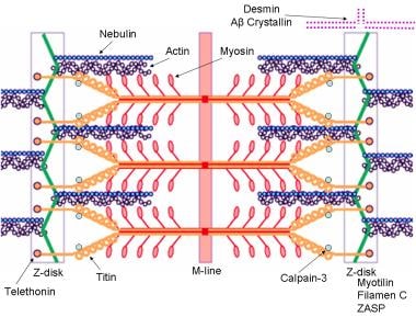 diagrams of people with muscular dystrophy