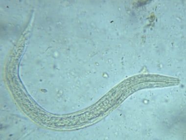 Hookworm rhabditiform larva. Courtesy of the Cente