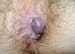 Hemorrhoids
