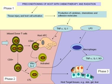 Pathophysiological pathways and mechanisms of acut