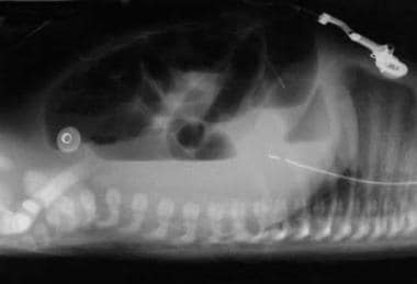 Supine shoot-through lateral abdominal radiograph 