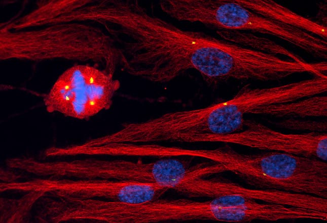 Ilustracao 3d Das Celulas Cancerosas E Dos Linfocitos Ilustracao Stock Ilustracao De Cancerosas Linfocitos 102013010