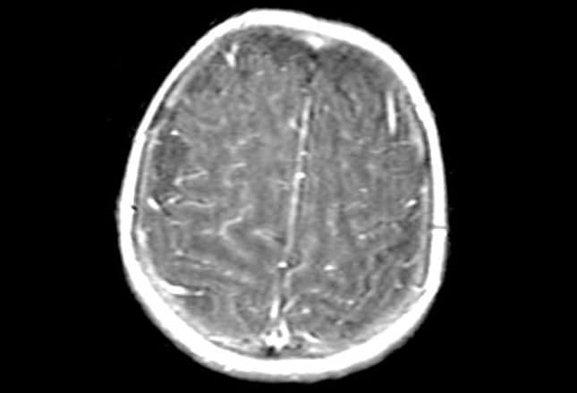 BRAIN TEST: NÍVEIS 77 a 92 RESOLVIDOS! 