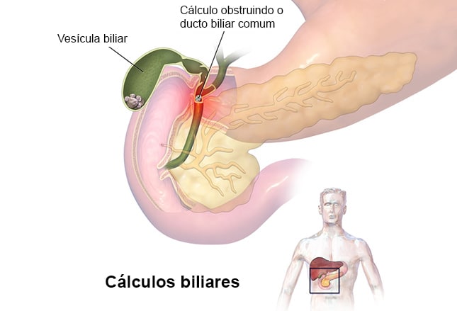 Sintomas atípicos como dor nas costas e no estômago podem indicar