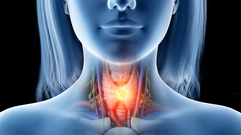 Onconews - TPEx é opção eficaz e segura no câncer de cabeça e pescoço  avançado