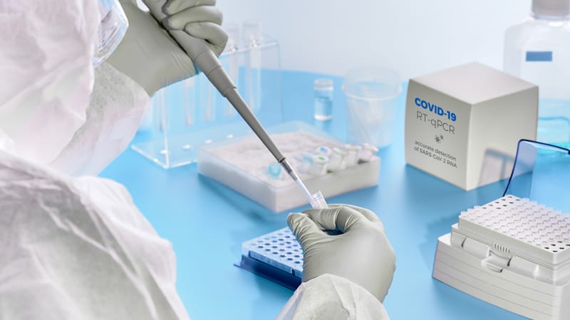 O que está mudando nos exames laboratoriais para covid-19