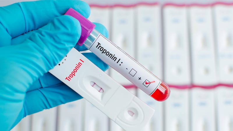 Algoritmos de avaliação da troponina de alta sensibilidade