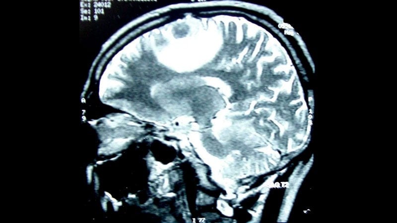 Bronstein - RM, Já imaginou um exame que pode detalhar todos os tecidos do  corpo em imagem, detectar cânceres, mapear a atividade cerebral e, ao  contrário do raio-X, não