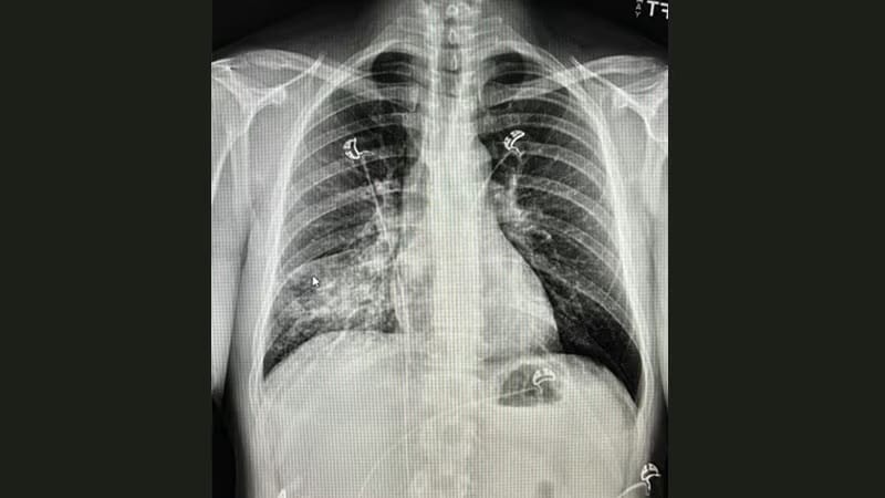 Desafio Diagnóstico: Motorista de caminhão com tosse persistente - Page 3