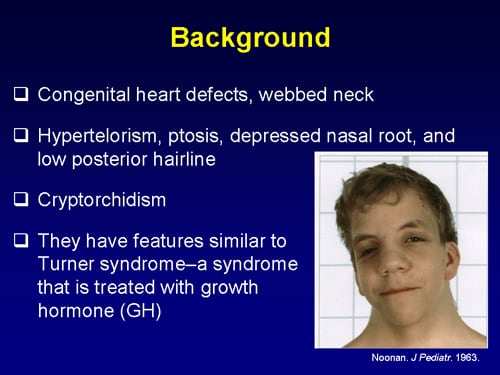 Noonan Syndrome Life Expectancy