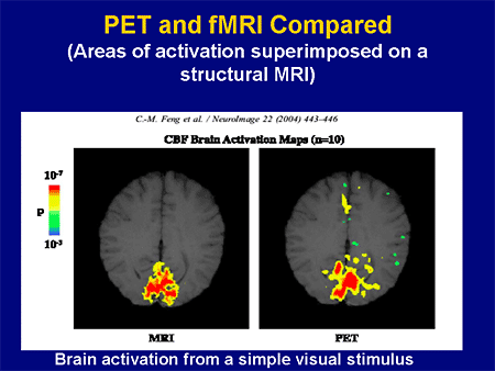 netspot pet scan