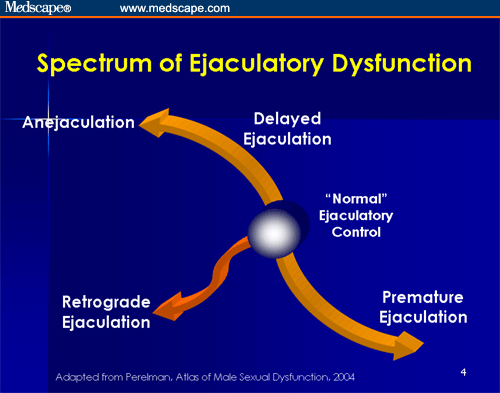 Premature Ejaculation Increasing Recognition And Improving Treatment