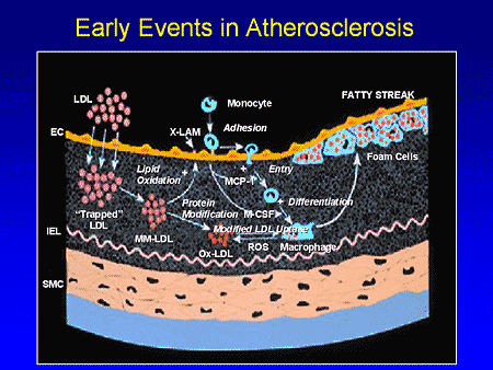 Slide 2. Early Events in Atherosclerosis