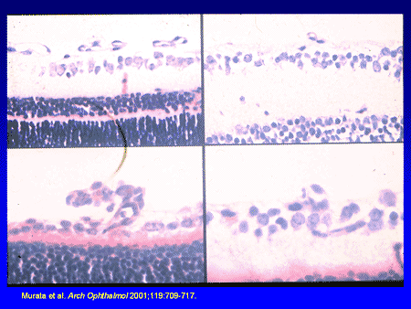 Slide 21. Neovascular Formation in Response to VEGF In Vivo