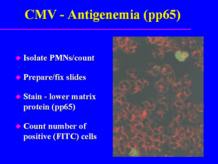 Emerging Trends In The Management Of CMV After Bone Marrow...