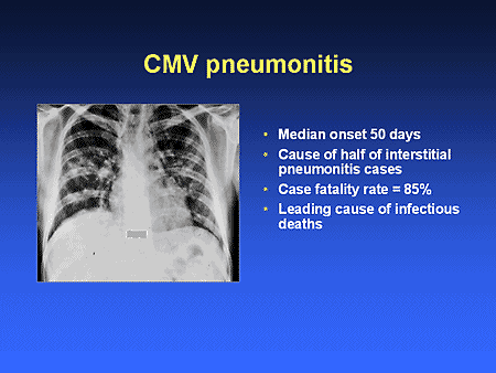 Emerging Trends in the Management of CMV After Bone Marrow...