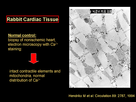 New Approaches to Myocardial Protection