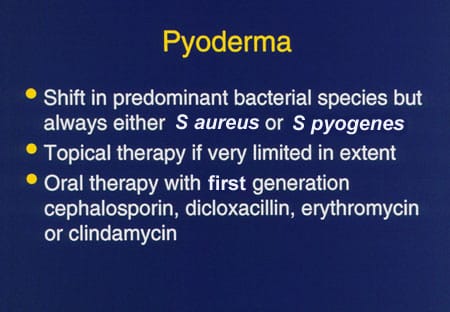 Icd Pyoderma Masters of Pediatrics: Infectious Disease Update 1