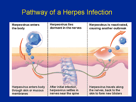 Pathway of a Herpes Infection