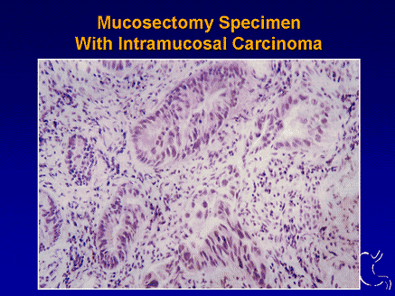 Broadening the Applications of COX-2 Specific Inhibition in ...
