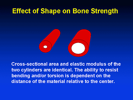 New Paradigms in the Management of Osteoporosis