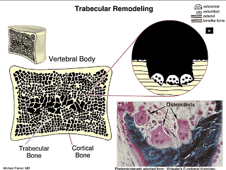 New Paradigms in the Management of Osteoporosis